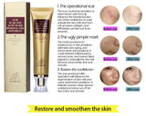 Acne Scar Removal Cream 30ml